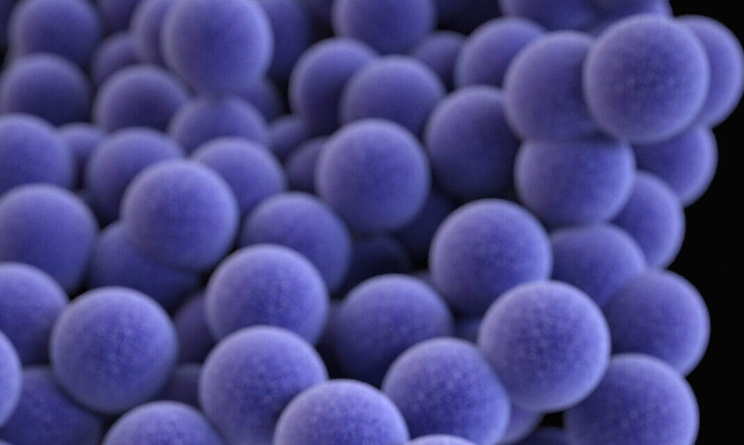 What is the Difference Between HA-MRSA and CA-MRSA?